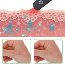 Lade das Bild in den Galerie-Viewer, Stichweg - zur effektiven Behandlung von Insektenstichen- und bissen